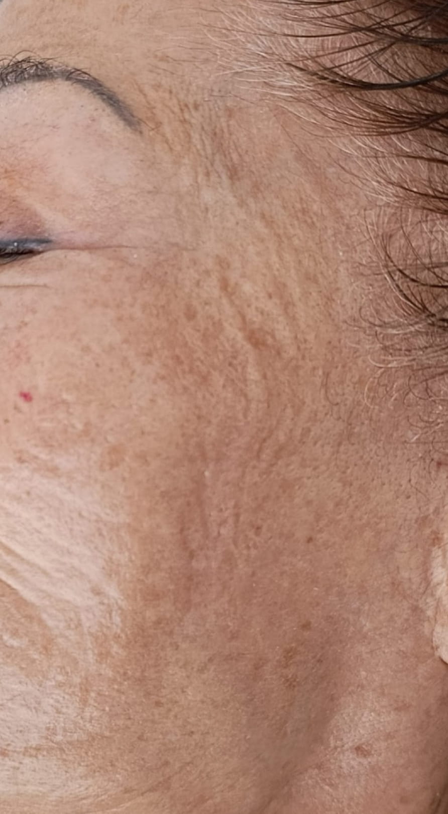 אחרי הטיפול